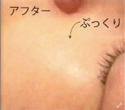 「煌水フェイスウォーター」After