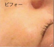 「煌水フェイスウォーター」Before